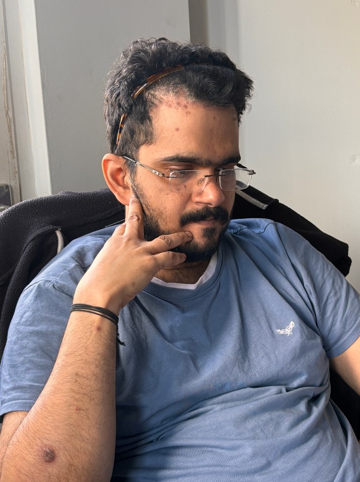 How Psoriasis Became My Unlikely&nbsp;Teacher